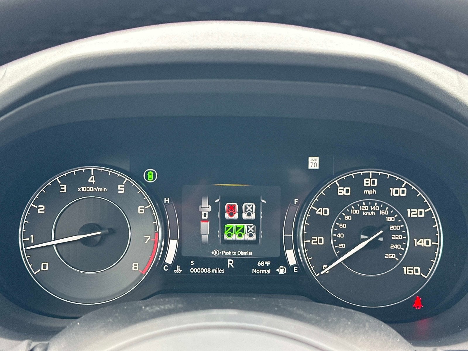 2026 Acura RDX w/Technology Package